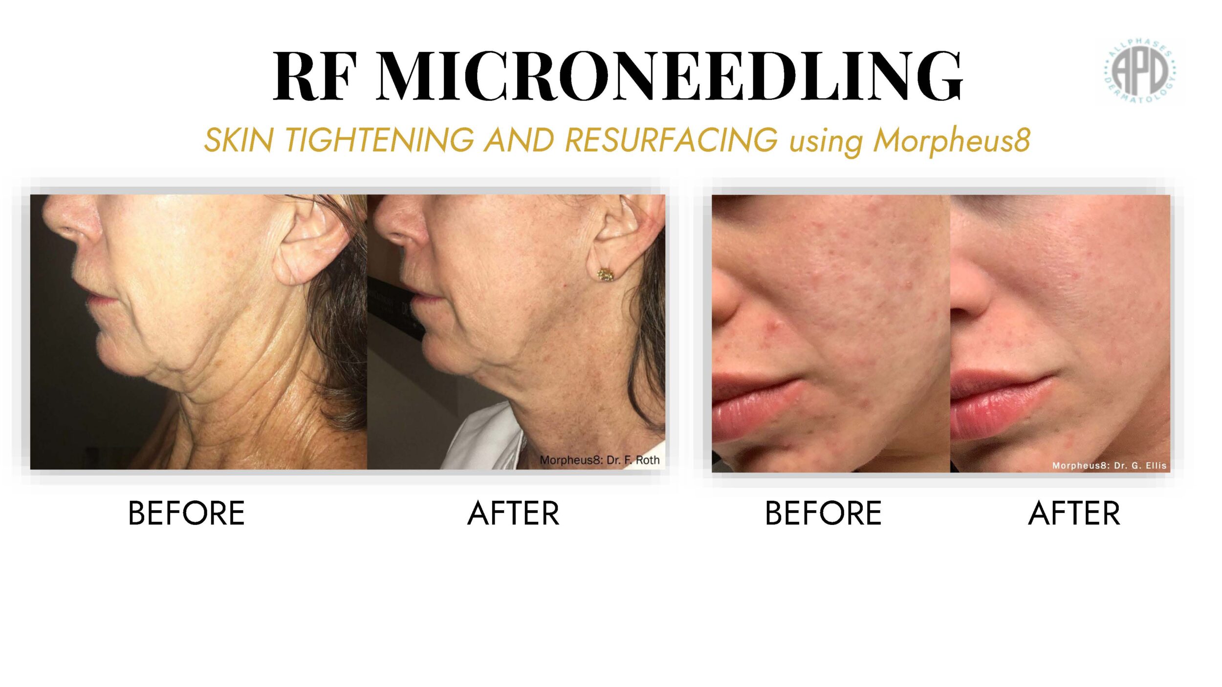 APD June 2025 Powerpoint Presentation revised MyAdvvice Sara Ibrahim Page 17